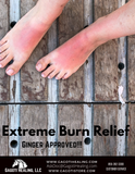 Extreme Burn Relief Moisturizer Spray
