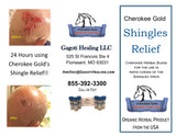 Shingles Relief