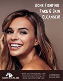 Facial Cleanser for Acne Prone Skin