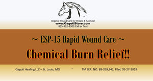 Chemical Burn Relief Nearly Instantly with ESP-15!!