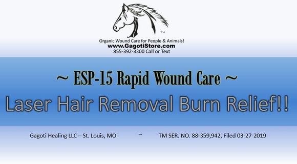Laser Hair Removal Burn Relief with ESP-15!!!
