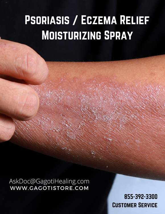 Psoriasis / Eczema Moisturizing Spray